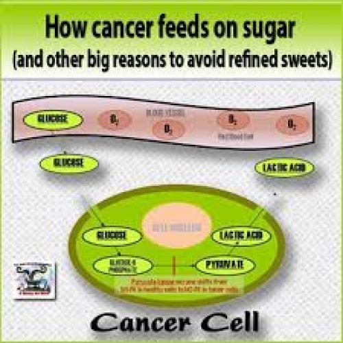 Now identified, sugar and cancer are indeed ‘directly’ connected